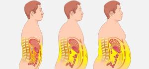 کشف جدید؛ راز سوزاندن چربی در سلول‌های انسانی